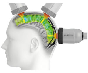 tcs-tps-neuro